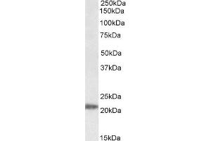 Western Blotting (WB) image for anti-IMP3, U3 Small Nucleolar Ribonucleoprotein (IMP3) antibody (ABIN5935464) (IMP3 anticorps)