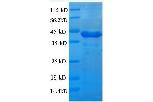 SDS-PAGE (SDS) image for Casein Kinase 1, alpha 1 (CSNK1A1) (AA 2-337) protein (His tag) (ABIN5709341) (CSNK1A1 Protein (AA 2-337) (His tag))