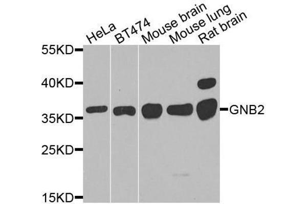 GNB2 anticorps  (AA 1-340)