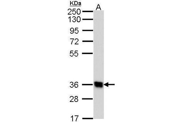 GPR62 anticorps  (N-Term)