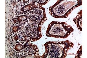 Immunohistochemical analysis of paraffin-embedded human-small-intestine, antibody was diluted at 1:200. (GREM2 anticorps  (AA 71-120))