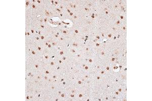 Immunohistochemistry of paraffin-embedded rat brain using RBM3 antibody  at dilution of 1:100 (40x lens). (RBM3 anticorps  (AA 1-157))