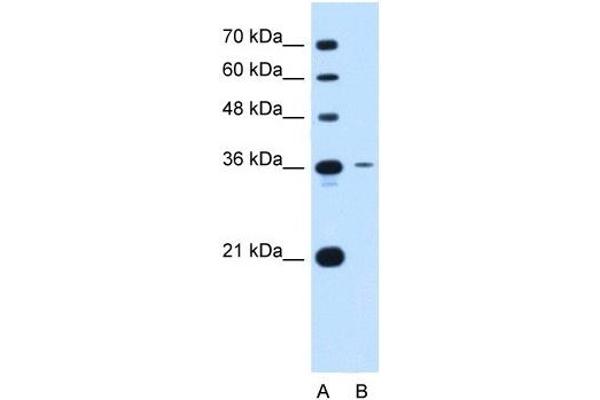 Tetraspanin 5 anticorps  (Middle Region)