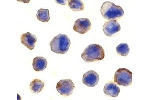 Immunohistochemistry (IHC) image for anti-MAP-Kinase Activating Death Domain (MADD) (C-Term) antibody (ABIN1030503) (MADD anticorps  (C-Term))