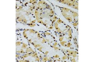 Immunohistochemistry of paraffin-embedded human stomach using ALYREF antibody (ABIN5973579) at dilution of 1/100 (40x lens). (THO Complex 4 anticorps)