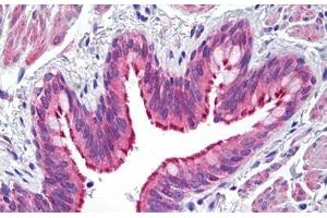 Anti-ATP7B antibody IHC staining of human lung, respiratory epithelium. (ATP7B anticorps  (AA 161-210))