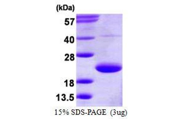 TRAPPC3 Protein (His tag)