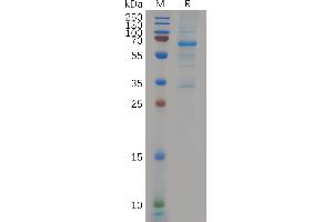 Human C Protein, hFc Tag on SDS-PAGE under reducing condition. (EVA1C Protein (AA 49-320) (Fc Tag))