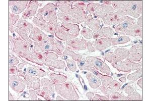 Image no. 1 for anti-Patatin-Like phospholipase Domain Containing 2 (PNPLA2) (Internal Region) antibody (ABIN372772) (PNPLA2 anticorps  (Internal Region))