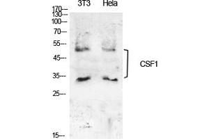 Western Blot analysis of NIH-3T3, hela cells using M-CSF Polyclonal Antibody. (M-CSF/CSF1 anticorps  (C-Term))