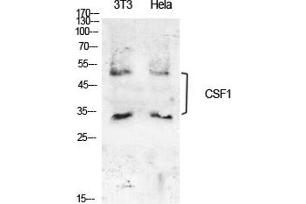 M-CSF/CSF1 anticorps  (C-Term)