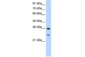 GIPC2 antibody used at 1. (GIPC2 anticorps  (N-Term))