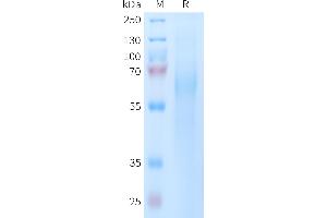 TIMD4 Protein (AA 25-314) (His tag)