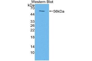 Western Blotting (WB) image for anti-Transmembrane Protein 27 (TMEM27) (AA 12-222) antibody (ABIN1871656) (TMEM27 anticorps  (AA 12-222))