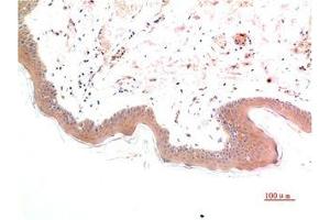 Immunohistochemical analysis of paraffin-embedded Human Skin Tissue using Phospho-Smad3(S425) Mouse mAb diluted at 1:200. (Phospho-SMAD3(S425) (pSer425) anticorps)