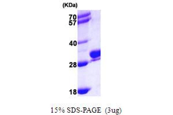 RAB27B Protein (AA 1-218) (His tag)