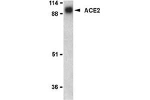 Image no. 2 for anti-Angiotensin I Converting Enzyme 2 (ACE2) (N-Term) antibody (ABIN319091) (ACE2 anticorps  (N-Term))