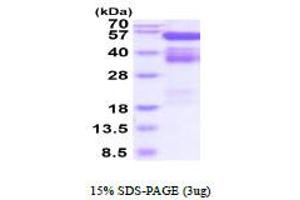 SDS-PAGE (SDS) image for EPH Receptor B4 (EPHB4) (AA 16-539) protein (His tag) (ABIN6387866) (EPH Receptor B4 Protein (EPHB4) (AA 16-539) (His tag))