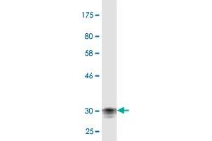 Western Blot detection against Immunogen (31. (Corneodesmosin anticorps  (AA 306-355))