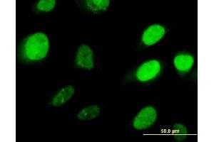 Immunofluorescence of monoclonal antibody to HOXD3 on HeLa cell. (HOXD3 anticorps  (AA 334-431))