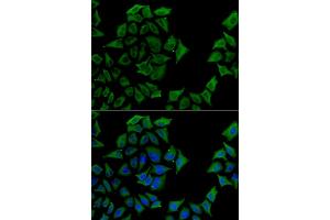 Immunofluorescence analysis of U2OS cells using TCN1 antibody (ABIN5973815). (TCN1 anticorps)