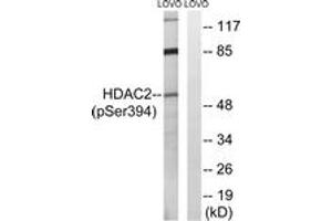 Western blot analysis of extracts from LOVO cells, using HDAC2 (Phospho-Ser394) Antibody. (HDAC2 anticorps  (pSer394))