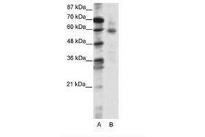 Image no. 1 for anti-Forkhead Box O1 (FOXO1) (N-Term) antibody (ABIN202855) (FOXO1 anticorps  (N-Term))