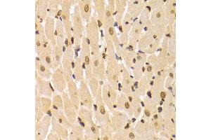 Immunohistochemistry (IHC) image for anti-Lamin A/C (LMNA) (AA 403-572) antibody (ABIN3020785)