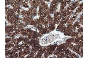 Immunohistochemical staining of paraffin-embedded Human liver tissue using anti-CYP2A6 mouse monoclonal antibody. (CYP2A6 anticorps)