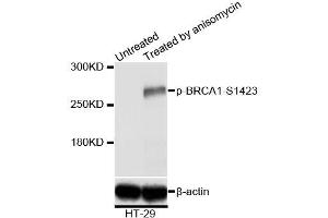 Western blot analysis of extracts of HT-29 cells,using Phospho-BRCA1-S1423 antibody (ABIN5969949) at 1/2000 dilution. (BRCA1 anticorps  (pSer1423))