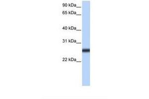 Image no. 1 for anti-Transmembrane Protease, serine 5 (TMPRSS5) (AA 270-319) antibody (ABIN6739260) (TMPRSS5 anticorps  (AA 270-319))