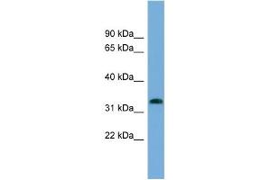 WB Suggested Anti-IFI35 Antibody Titration:  0. (IFI35 anticorps  (N-Term))