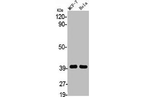 Western Blot analysis of MCF7 HELA cells using 3β-HSD7 Polyclonal Antibody (HSD3B7 anticorps  (Internal Region))