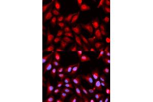 Immunofluorescence analysis of U2OS cells using DDX5 antibody. (DDX5 anticorps)