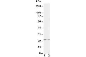 Western blot testing of SOCS1 antibody and Lane 1:  HT1080 (SOCS1 anticorps  (C-Term))