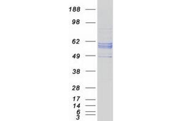 CYP27A1 Protein (Myc-DYKDDDDK Tag)