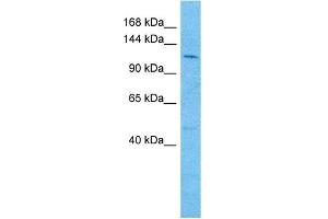 Host:  Rabbit  Target Name:  REST  Sample Type:  721_B Whole Cell lysates  Antibody Dilution:  1. (REST anticorps  (N-Term))