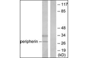 Western blot analysis of extracts from 293 cells, using PGP9. (UCHL1 anticorps  (C-Term))