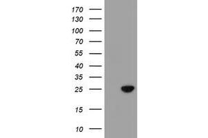 HEK293T cells were transfected with the pCMV6-ENTRY control (Left lane) or pCMV6-ENTRY C21orf56 (Right lane) cDNA for 48 hrs and lysed. (C21ORF56 anticorps)