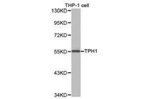 Western Blotting (WB) image for anti-Tryptophan Hydroxylase 1 (TPH1) antibody (ABIN1875176) (Tryptophan Hydroxylase 1 anticorps)