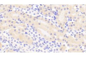 Detection of CTH in Mouse Kidney Tissue using Polyclonal Antibody to Cystathionine (CTH) (Cystathionine (AA 14-224) anticorps)