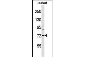 RHOBTB1 Antibody (C-term) (ABIN1537507 and ABIN2848711) western blot analysis in Jurkat cell line lysates (35 μg/lane). (RHOBTB1 anticorps  (C-Term))