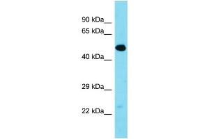 Western Blotting (WB) image for anti-Transmembrane Protein 39A (TMEM39A) (Middle Region) antibody (ABIN2500427) (TMEM39A anticorps  (Middle Region))