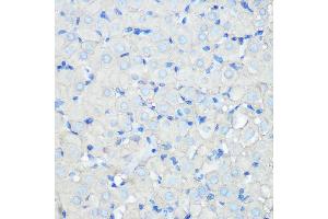 Immunohistochemistry of paraffin-embedded rat ovary using SR-BI Rabbit mAb (ABIN7270156) at dilution of 1:100 (40x lens). (SCARB1 anticorps)