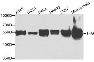 Western blot analysis of extracts of various cell lines, using TFG antibody. (TFG anticorps  (AA 1-240))