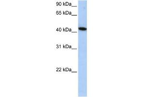 WB Suggested Anti-ICA1L Antibody Titration: 0. (ICA1L anticorps  (Middle Region))