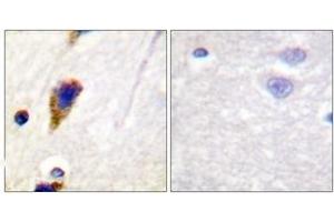 Immunohistochemistry (IHC) image for anti-Dynamin 1 (DNM1) (AA 740-789) antibody (ABIN2888626) (Dynamin 1 anticorps  (AA 740-789))