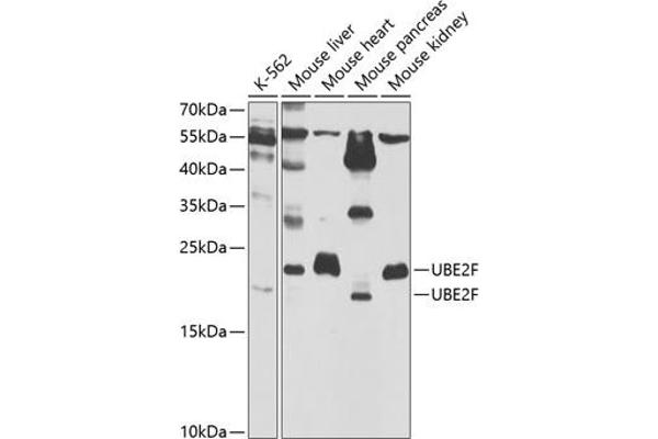 UBE2F anticorps  (AA 1-185)