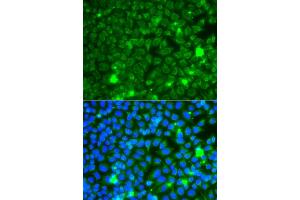 Immunofluorescence analysis of A549 cells using GBA3 antibody. (GBA3 anticorps)