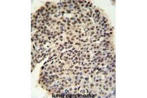 Immunohistochemistry (IHC) image for anti-Pre-mRNA Processing Factor 19 (PRPF19) antibody (ABIN3002151) (PRP19 anticorps)